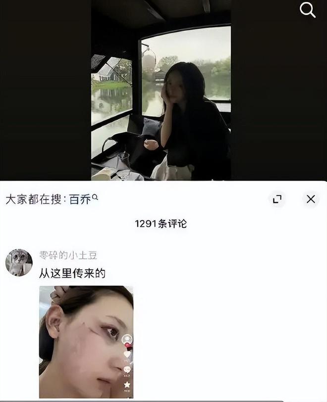 张百乔不再沉默！直面与小雪离婚传闻，现状浮出水面引关注  第11张